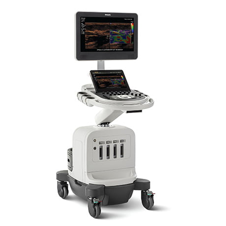 Ultrassom Philips Affiniti 50