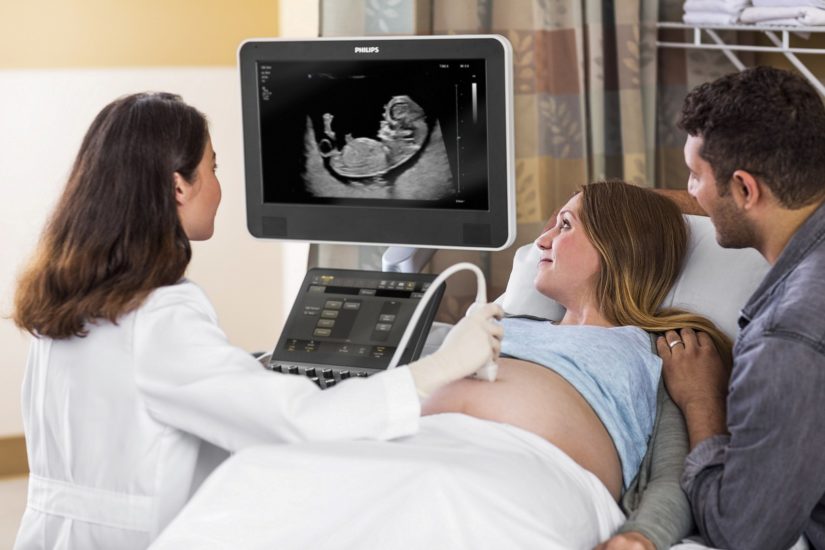 Ultrassom philips affiniti 70