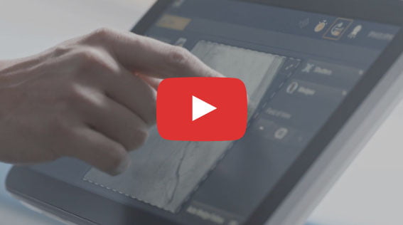 Philips Azurion Thumbnail Video