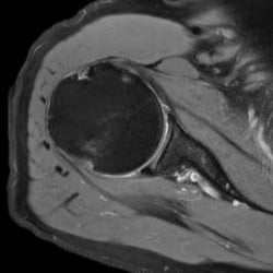 Ressonância Magnética Philips Ingenia Omega - Imagem Clínica 1