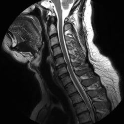 Ressonância Magnética Philips Ingenia Omega - Imagem Clínica 2