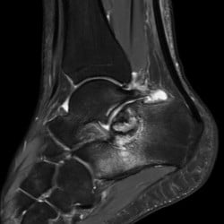 Ressonância Magnética Philips Ingenia Omega - Imagem Clínica 3