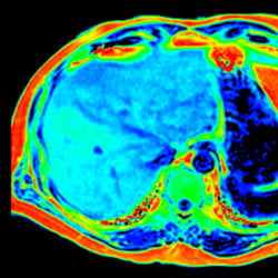Ressonância Magnética Philips Ingenia Omega - Imagem Clínica 4