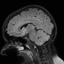 Ressonância Magnética Philips Ingenia Omega - Imagem Clínica 5