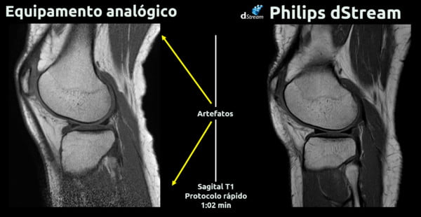 Ressonância Magnética Philips Ingenia Prodiva CS - 22 - dStream - Sinal Digital
