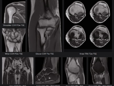 Ressonância Magnética Philips Ingenia Prodiva CS - Imagem Clínica - MSK