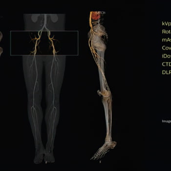 Tomógrafo Philips Access CT - Imagem Clínica - 2