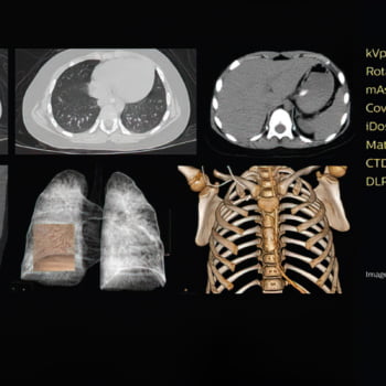Tomógrafo Philips Access CT - Imagem Clínica - 3