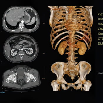 Tomógrafo Philips Access CT - Imagem Clínica - 4