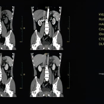 Tomógrafo Philips Access CT - Imagem Clínica - 5