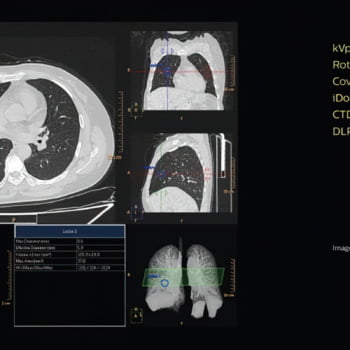 Tomógrafo Philips Access CT - Imagem Clínica - 6