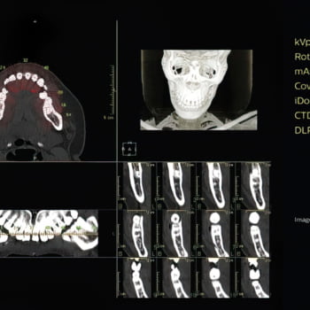 Tomógrafo Philips Access CT - Imagem Clínica - 8