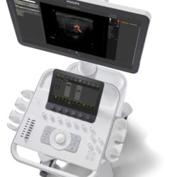 Ultrassom Philips 3300 - Cima