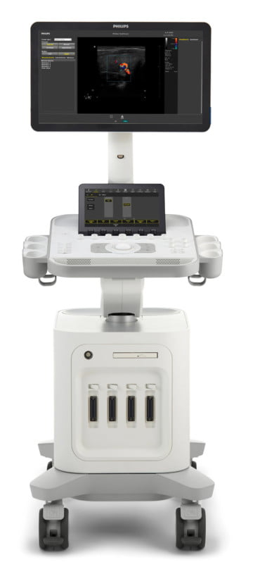 Philips Ultrassom 3300 Especificações Técnicas