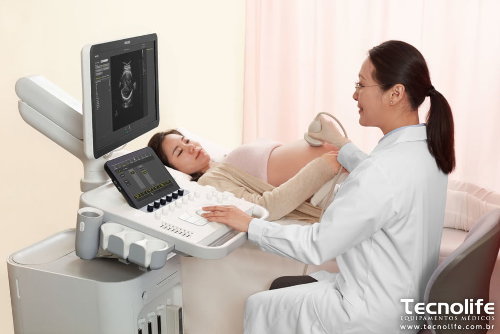 Philips Ultrassom 3300 8 - 2