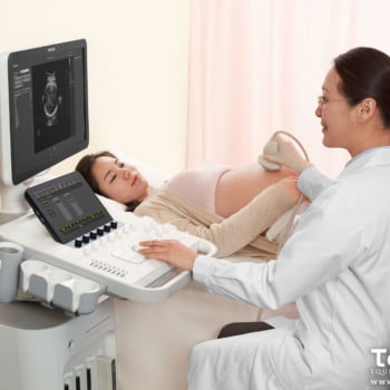 Philips Ultrassom 3300 8 - 2