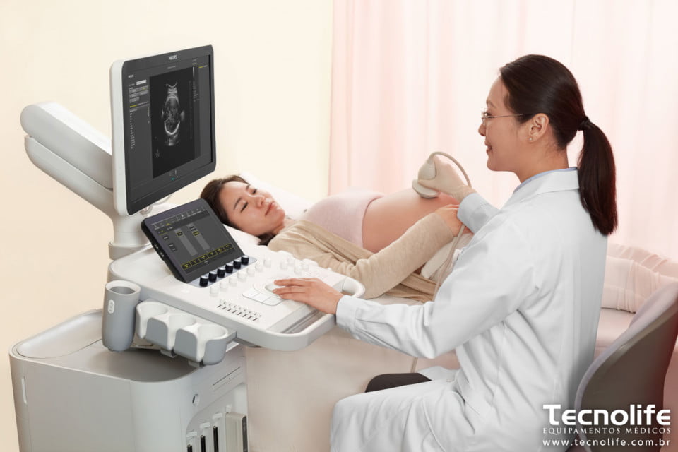 Philips Ultrassom 3300 8 - 2