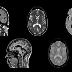 Ressonância Magnética Philips MR 5300 - Imagem Clínica - 1