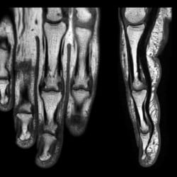 Ressonância Magnética Philips MR 5300 - Imagem Clínica - 3