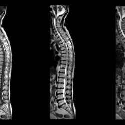 Ressonância Magnética Philips MR 5300 - Imagem Clínica - 4
