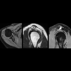 Ressonância Magnética Philips MR 5300 - Imagem Clínica - 7