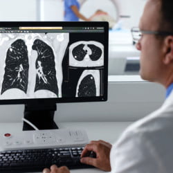 Tomógrafo Philips Incisive CT - 17