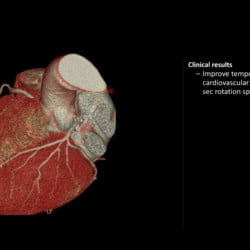 Tomógrafo Philips Incisive CT - Imagem Clínica - 1