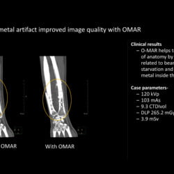 Tomógrafo Philips Incisive CT - Imagem Clínica - 10