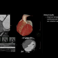 Tomógrafo Philips Incisive CT - Imagem Clínica - 2