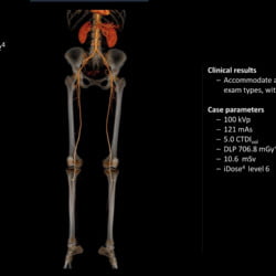 Tomógrafo Philips Incisive CT - Imagem Clínica - 3