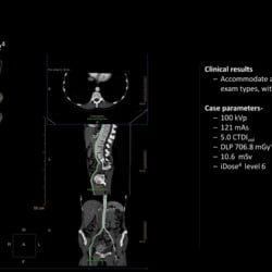Tomógrafo Philips Incisive CT - Imagem Clínica - 4