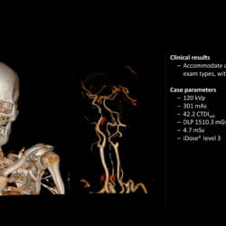 Tomógrafo Philips Incisive CT - Imagem Clínica - 5