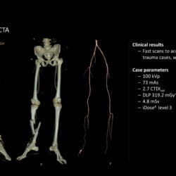 Tomógrafo Philips Incisive CT - Imagem Clínica - 6