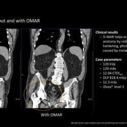 Tomógrafo Philips Incisive CT - Imagem Clínica - 7