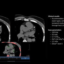 Tomógrafo Philips Incisive CT - Imagem Clínica - 8