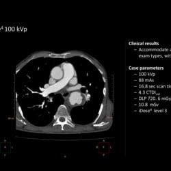 Tomógrafo Philips Incisive CT - Imagem Clínica - 9