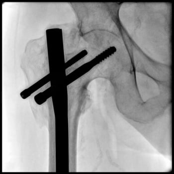 Philips Zenition 10 - Imagem Clínica - 1