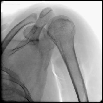 Philips Zenition 10 - Imagem Clínica - 3