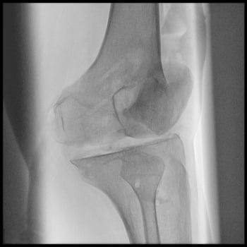 Philips Zenition 10 - Imagem Clínica - 4