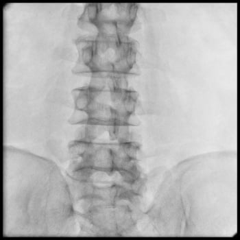 Philips Zenition 10 - Imagem Clínica - 5