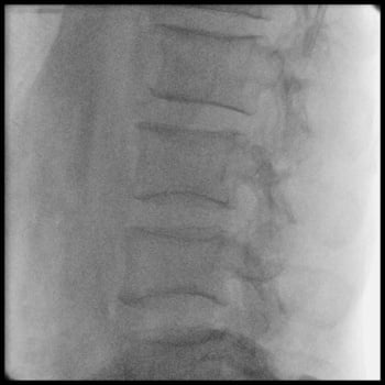 Philips Zenition 10 - Imagem Clínica - 6