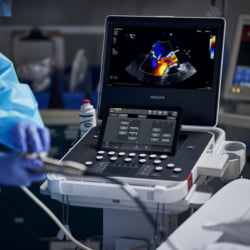 Ultrassom Portátil Philips Compact 5000 - 25