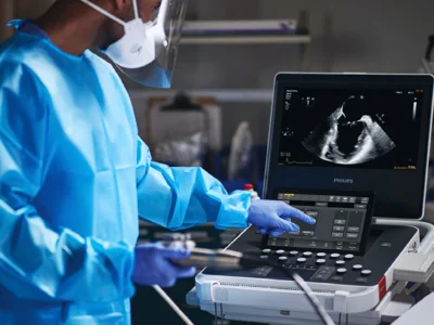 Ultrassom Portátil Philips Compact 5000 - 30