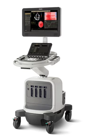 Ecocardiografia - Philips Affiniti 70