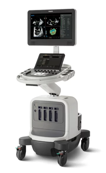 Ecocardiografia - Philips Affiniti CVx