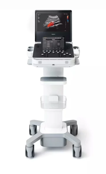 Ecocardiografia - Philips Compacto 5300