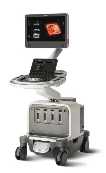 Ecocardiografia - Philips EPIQ CVx