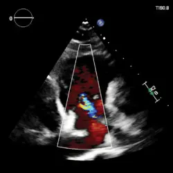 Ultrassom Philips Affiniti CVx - Imagem Clínica - 7