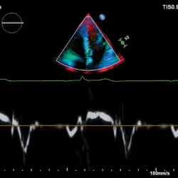 Ultrassom Philips Affiniti CVx - Imagem Clínica - 8